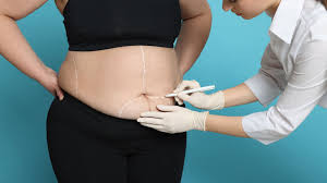 Bariatric Surgery Specialist in Thane | Weight Loss Surgeon