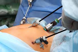 Appendectomy Surgery in Thane - Best Treatment by Dr. Pradeep Tripathi at Tieten Hospital
