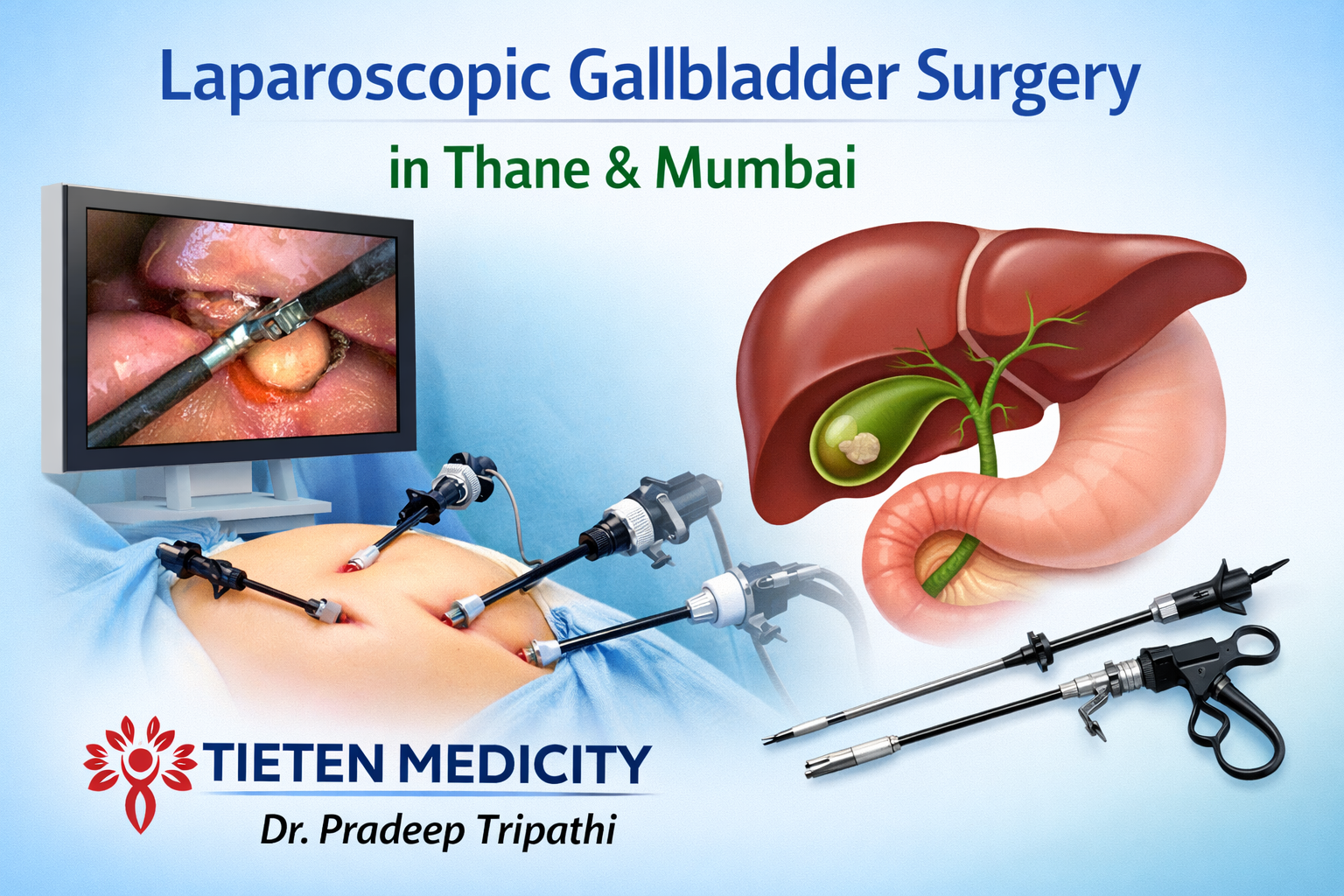 Best Robotic Gallbladder Surgeon in Thane | Mumbai Near Me