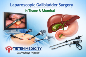 Laparoscopic Gallbladder Surgery in Thane & Mumbai