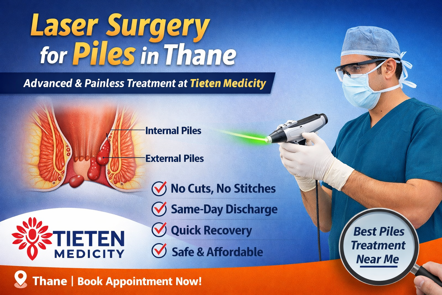 Advanced Laser Piles Surgery in Thane | Cost, Symptoms & Treatment Guide