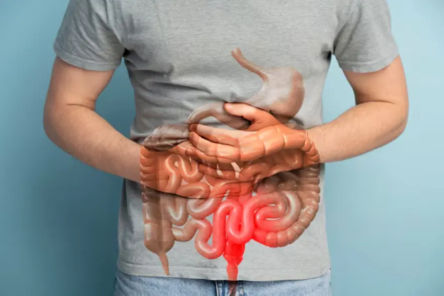 Laparoscopic Surgery for Rectal Prolapse in Thane | Tieten Medicity Hospital